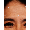 Activator-diminuare riduri dinamice Clinical Solutions®